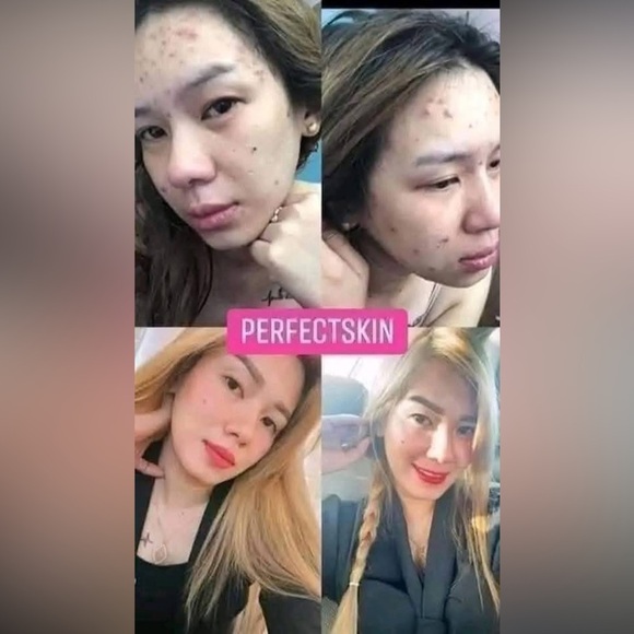 💓Perfect Skin Rejuv set💓 - Picture 4 of 8